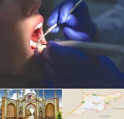 عصب کشی در سمنان