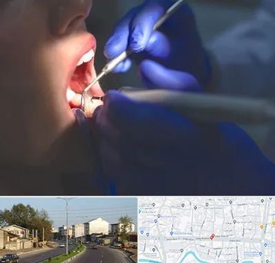 عصب کشی در ضیابری رشت