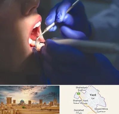 عصب کشی در یزد