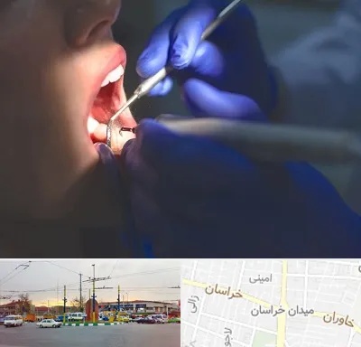 عصب کشی در میدان خراسان