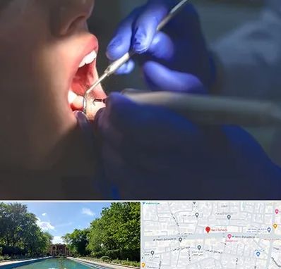 عصب کشی در هشت بهشت اصفهان