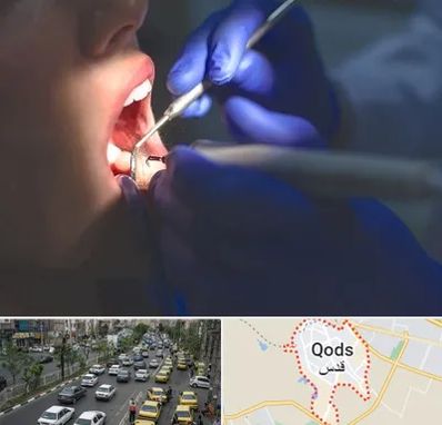 عصب کشی در شهر قدس