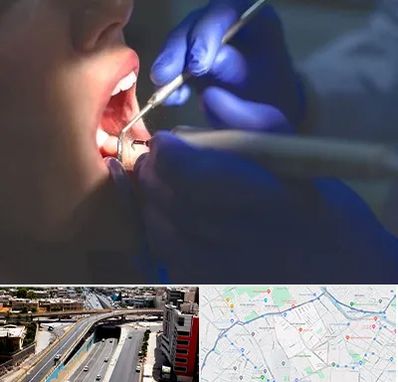 عصب کشی در ستارخان شیراز