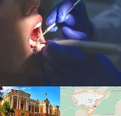 عصب کشی در خوی