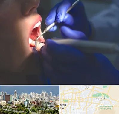 عصب کشی در شرق تهران 