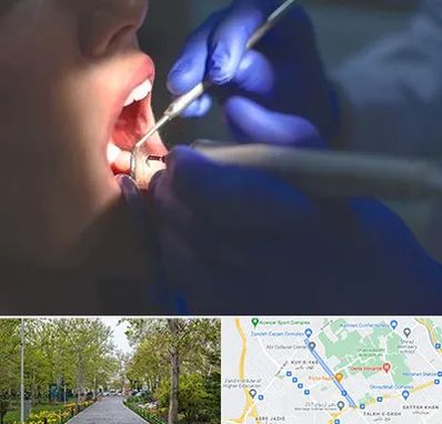 عصب کشی در قدوسی غربی شیراز