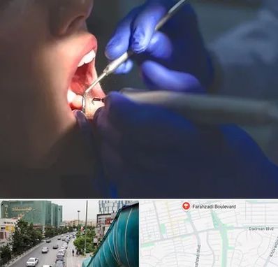 عصب کشی در بلوار فرحزادی