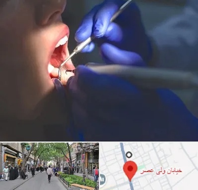 عصب کشی در ولیعصر شهریار