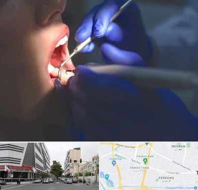 عصب کشی در بلوار فردوس 