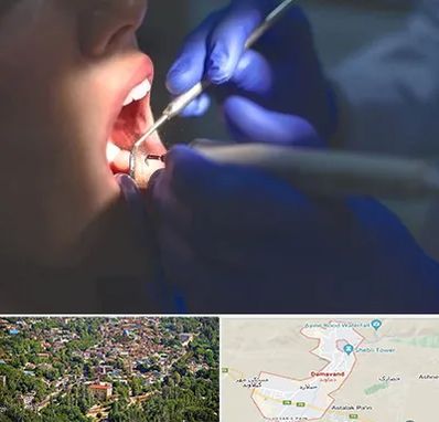 عصب کشی در دماوند