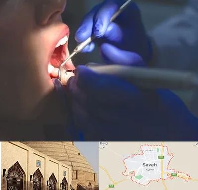 عصب کشی در ساوه