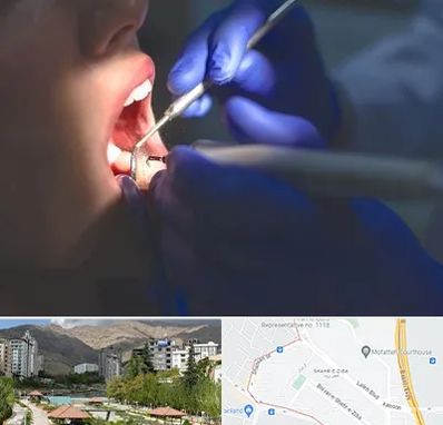 عصب کشی در شهر زیبا