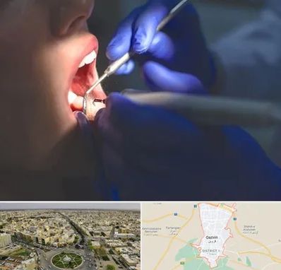 عصب کشی در قزوین