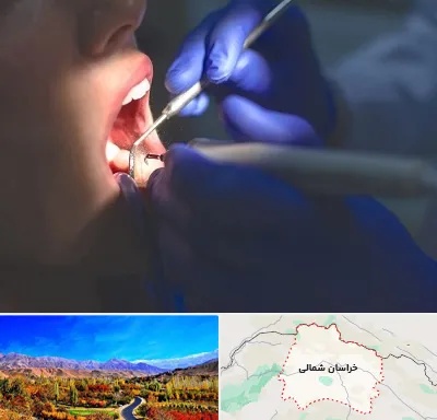 عصب کشی در خراسان شمالی