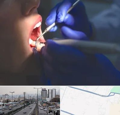 عصب کشی در بلوار ارتش