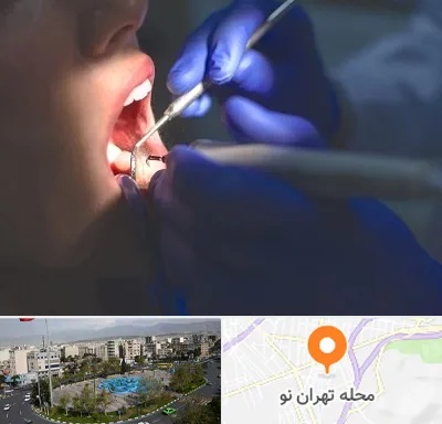 عصب کشی در تهران نو