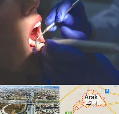 عصب کشی در اراک