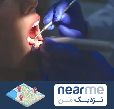 عصب کشی در نزدیک من