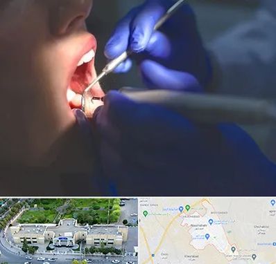 عصب کشی در نسیم شهر