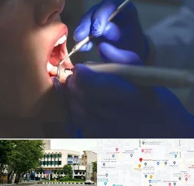 عصب کشی در طالقانی