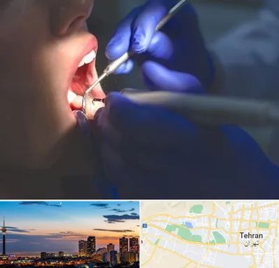 عصب کشی در غرب تهران 