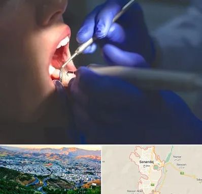 عصب کشی در سنندج