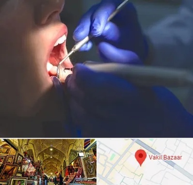 عصب کشی در بازار وکیل شیراز