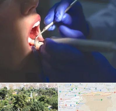 عصب کشی در منطقه 13 تهران