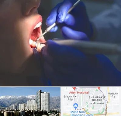 عصب کشی در شهرک غرب 