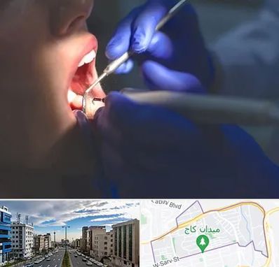 عصب کشی در سعادت آباد 