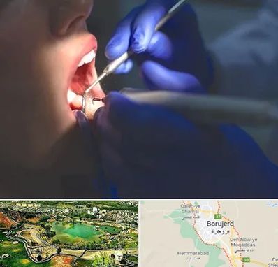 عصب کشی در بروجرد