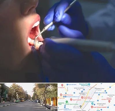 عصب کشی در شریعتی