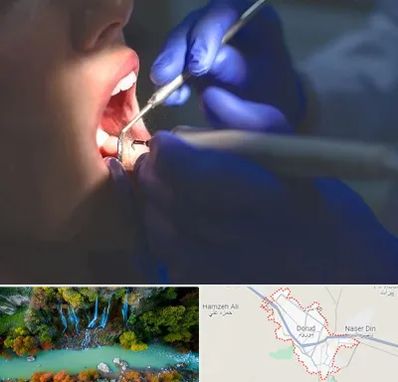 عصب کشی در دورود