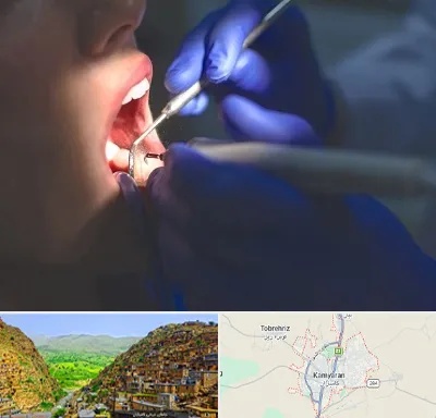 عصب کشی در کامیاران