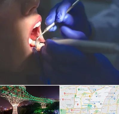 عصب کشی در منطقه 3 تهران