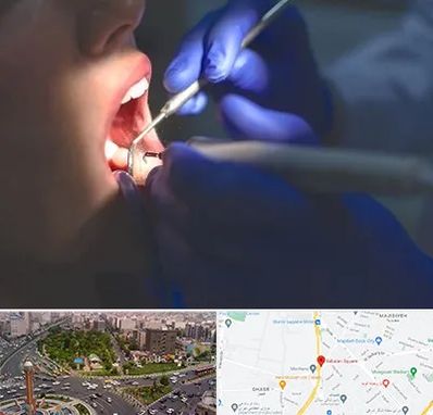 عصب کشی در سبلان