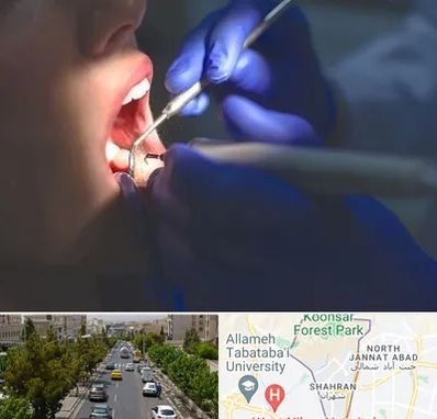 عصب کشی در شهران 