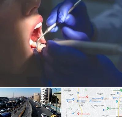 عصب کشی در پیروزی