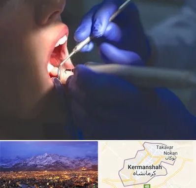 عصب کشی در کرمانشاه