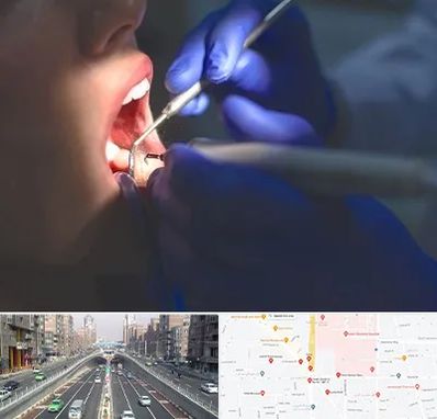 عصب کشی در توحید