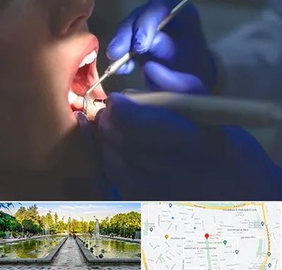 عصب کشی در سرسبز