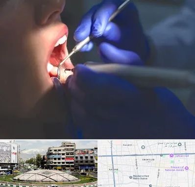 عصب کشی در مرکز تهران