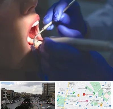 عصب کشی در بلوار فردوسی مشهد