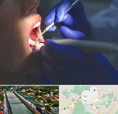 عصب کشی در مراغه