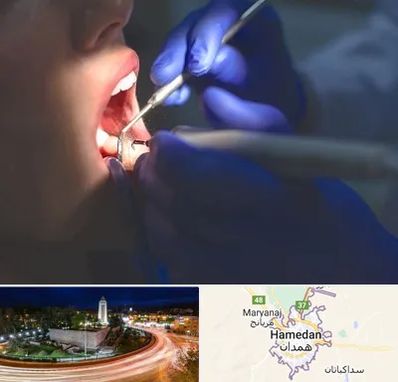 عصب کشی در همدان