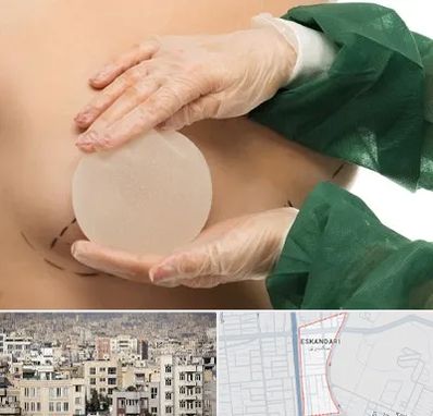 جراحی پروتز سینه در اسکندری