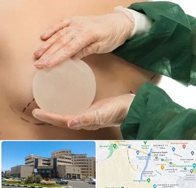 جراحی پروتز سینه در صیاد شیرازی مشهد