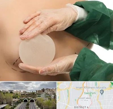 جراحی پروتز سینه در یوسف آباد