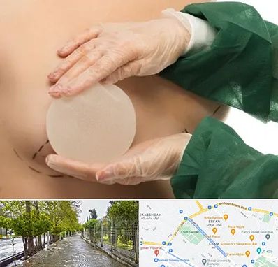 جراحی پروتز سینه در خیابان ارم شیراز