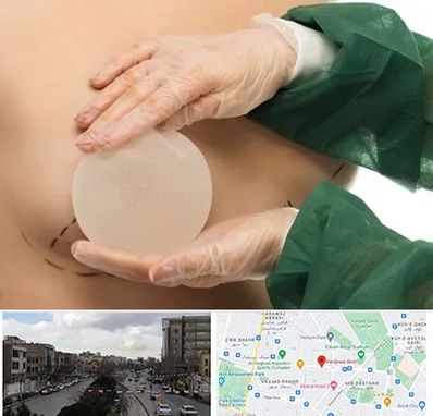 جراحی پروتز سینه در بلوار فردوسی مشهد